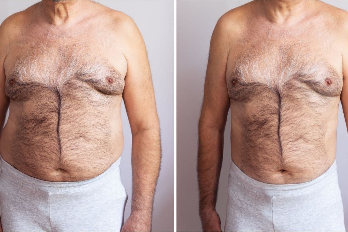 Before and after weightloss